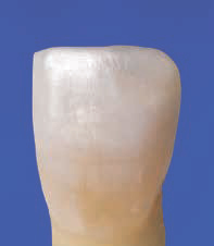 Ecusphere Shape A2 - после реставрации